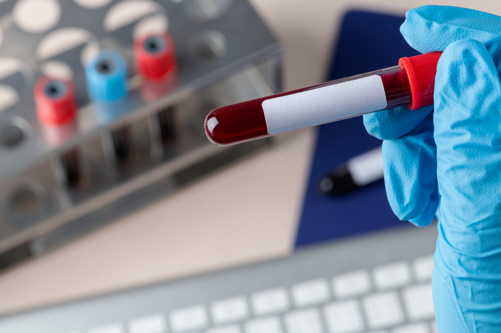 Hematology Case Studies